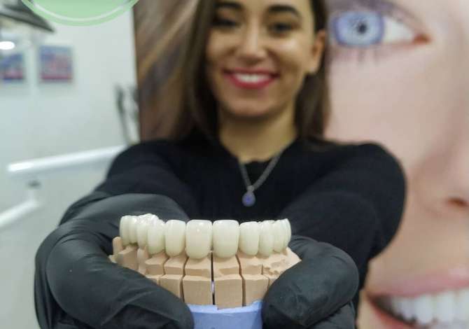 klinike dentare Klinika Dentare KetiDent ofron Mbushje estetike, Faseta dhe Buze, Zbardhim, Pier