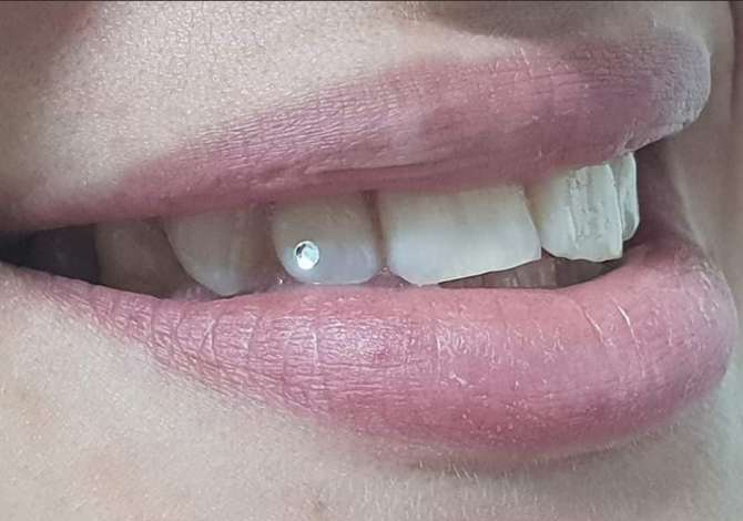 klinike dentare tirane Klinike Dentare Prestige ofron Mbushje estetike Piercing, Estraksion dhemballe e
