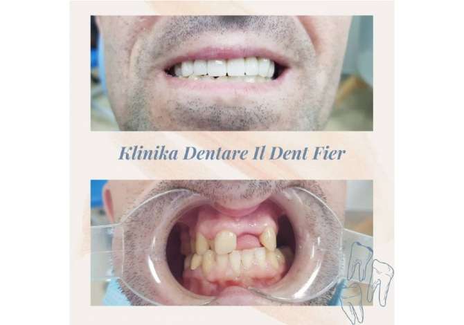 klinik estetike ne fier Klinika dentare ofron sherbim te specializuar ne kirurgji orale, ortodonci, endo