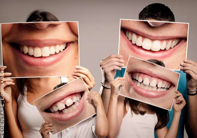klinike dentare Klinike Dentare EdonaDent, Specializuar prej shume vitesh ne Ortodontike